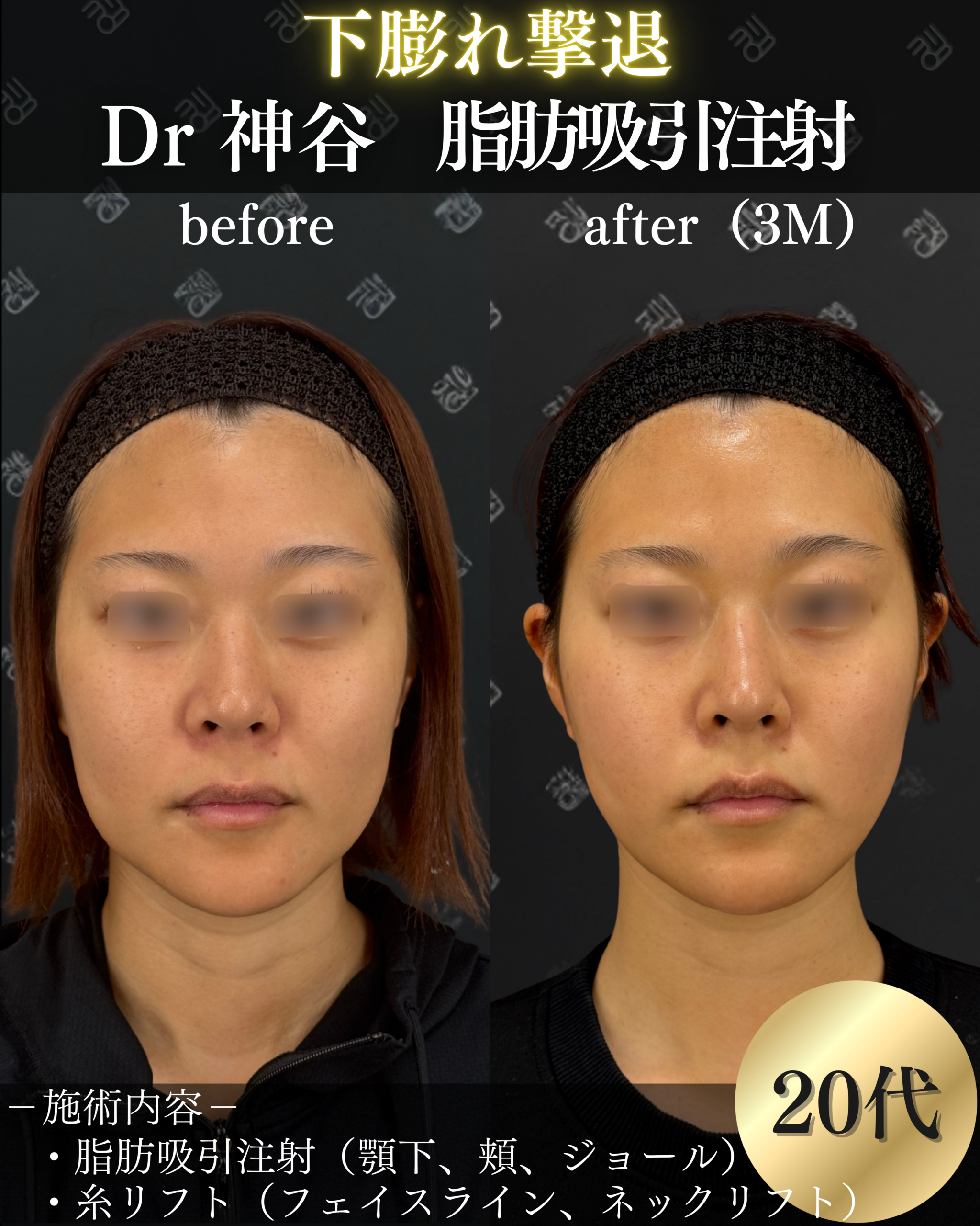 細く、でもやり過ぎないの写真(福井県敦賀市)